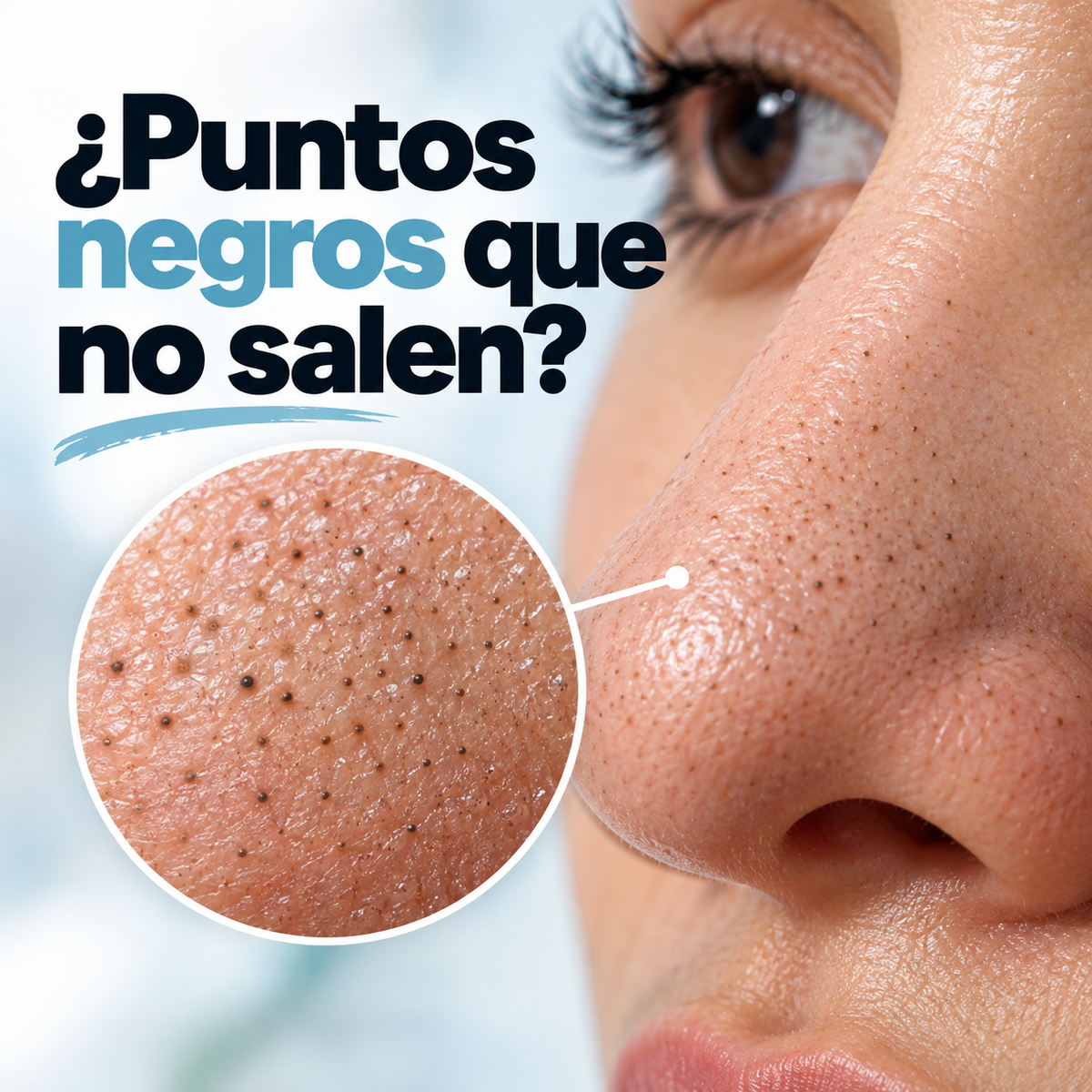 Extractor De Espinillas A Vapor:Limpieza Facial Profunda Desde Casa